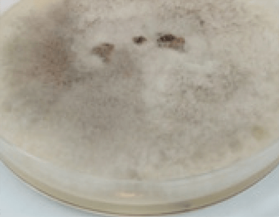 Figura 2. Colonia filamentosa ligeramente algodonosa de color blanquecino a gris claro con crecimiento de 15 días en agar sabouraud dextrosa.