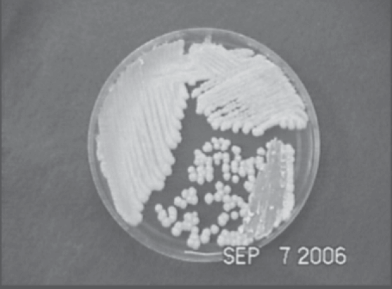 Figura 1. Colonias de Candida pelliculosa en Agar de Sabouraud.