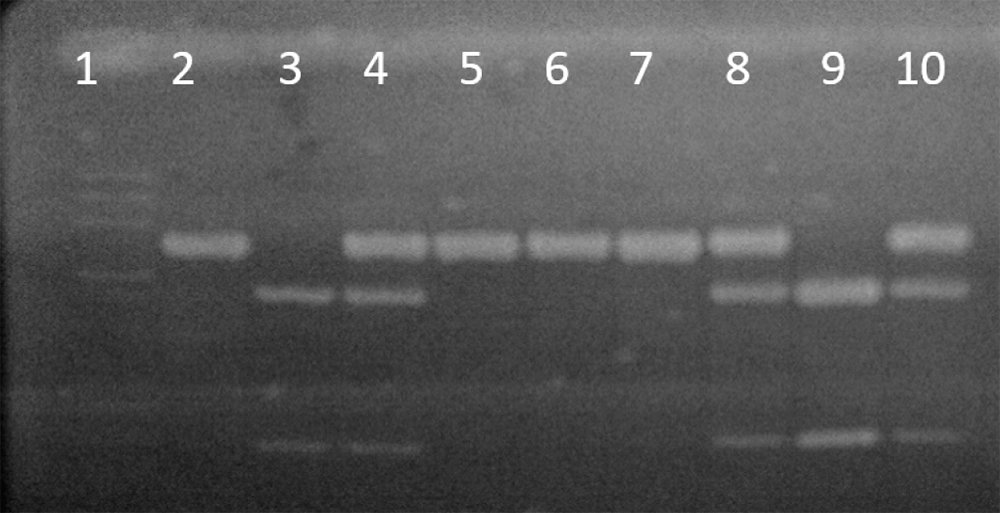 Figura 1. Gel de agarosa al 2 % corrido en electroforesis, mostrando el polimorfismo BsmI del gen VDR. Línea 1 Marcador de peso molecular Phix 174 cortado con enzima Hae III. Líneas 2,5-7 Individuos homocigotos B/B. Líneas 3,9 Individuos homocigotos b/b. Líneas 4,8,10 Individuos heterocigotos B/b.