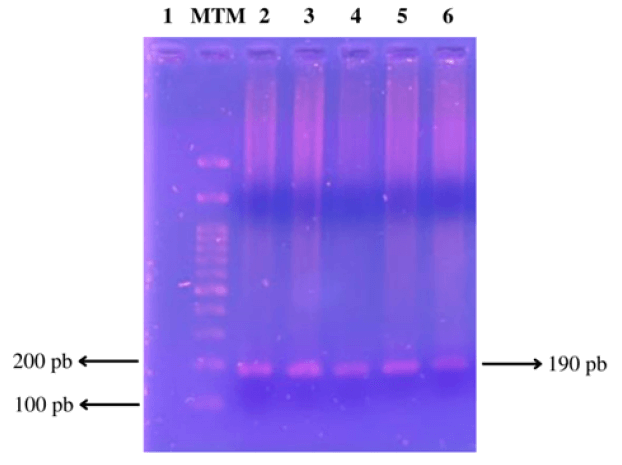 Figura N° 1. Productos amplificados por PCR del gen del receptor CD36. El carril 1 corresponde al control negativo. MTM (Marcador de tamaño molecular) de 100 pb (Promega). En los carriles 2, 3, 4, 5 y 6 se observa la amplificación del gen del receptor CD36 (190 pb).