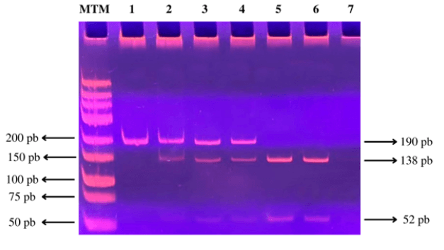 Figura N° 2. Producto de digestión del fragmento amplificado por PCR del gen del receptor CD36. MTM (marcador de tamaño molecular) de 25 pb (Promega). En el carril 1 se observa el genotipo homocigoto A/A, en los carriles 2, 3 y 4 se observa el genotipo heterocigoto G/A, en los carriles 5 y 6 se observa el genotipo homocigoto G/G, y en el carril 7 se encuentra el control negativo.