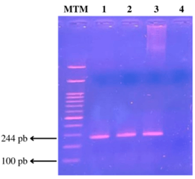 Figura N° 3. Productos amplificados por PCR de la variante 388 T/C (rs429358) y 526 C/T (rs7412) del gen APOE. MTM (Marcador de tamaño molecular). En los carriles 1, 2 y 3 se observa la amplificación del gen APOE (244 pb) y en el carril 4 se observa el control negativo.