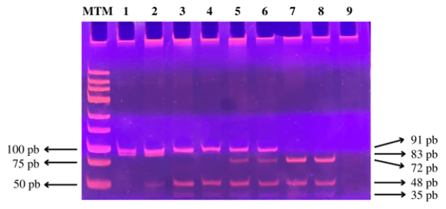Figura N° 4. Producto de digestión del fragmento amplificado por PCR del gen de la variante 388 T/C (rs429358) y 526 C/T (rs7412) del gen APOE. MTM (marcador de tamaño molecular) de 25 pb (Promega). En el carril 1 se observa el genotipo homocigoto E2/E2, en el carril 2 se observa el genotipo heterocigoto E3/E2, en los carriles 3 y 4 se observa el genotipo homocigoto E3/E3, en los carriles 5 y 6 se observa el genotipo heterocigoto E3/E4, en los carriles 7 y 8 se observa el genotipo homocigoto E4/ E4, y en el carril 9 se encuentra el control negativo.