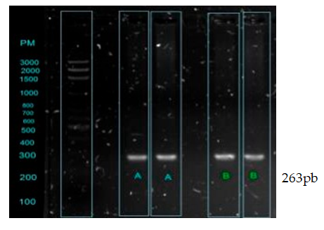 Figura N° 1. Productos amplificados por PCR del gen de IRS1. El carril 1 corresponde al marcador de tamaño molecular de 100 pb (Promega). Los carriles identificados como A y B corresponden a los productos amplificados del gen IRS1 (263 pb).