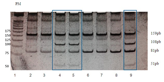 Figura N° 2. Producto de digestión del fragmento amplificado por PCR del gen de IRS1.