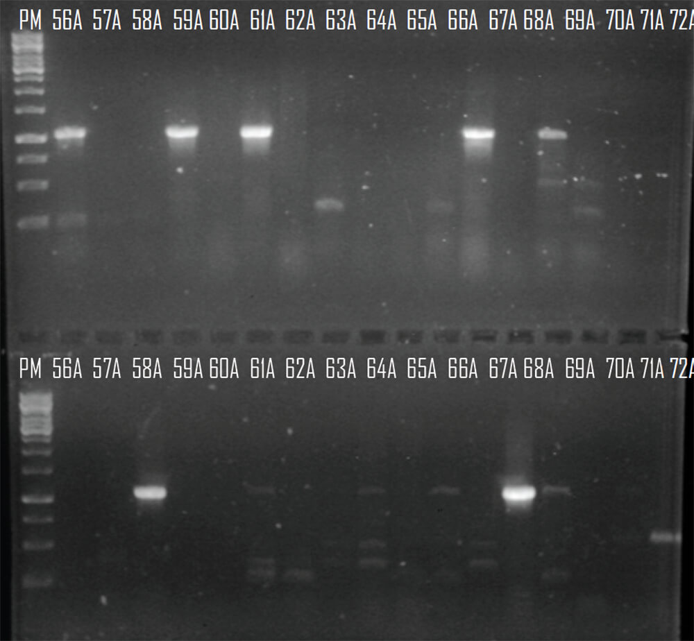 Figura 1. Registro fotográfico de un gel de agarosa al 0,8% donde se observan los amplificados del gen que codifica para la carbapenemasa OXA 23. Líneas 1 y 19: 1Kb DNA Ladder (BioLabs), Línea 2 y 3: Control positivo y negativo, Líneas 4-18 (41A-55A) y 20-36 (56A-72A) aislados clínicos provenientes del Hospital Dr. Domingo Luciani Fuente: Elaboración propia.