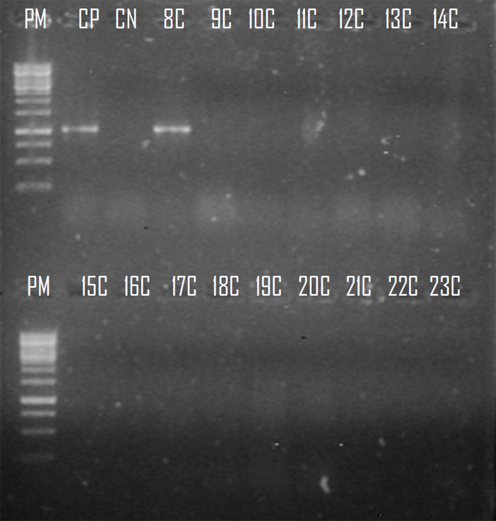 Figura 2. Amplificados del gen que codifica para la carbapenemasa OXA 72. Líneas 1 y 11: 1Kb DNA Ladder (BioLabs), Línea 2 y 3: Control positivo y negativo, Líneas 4-10 (8C-14C) y 12-20 (15C-23C) aislados clínicos provenientes del Centro Médico de Caracas. Fuente: Elaboración propia