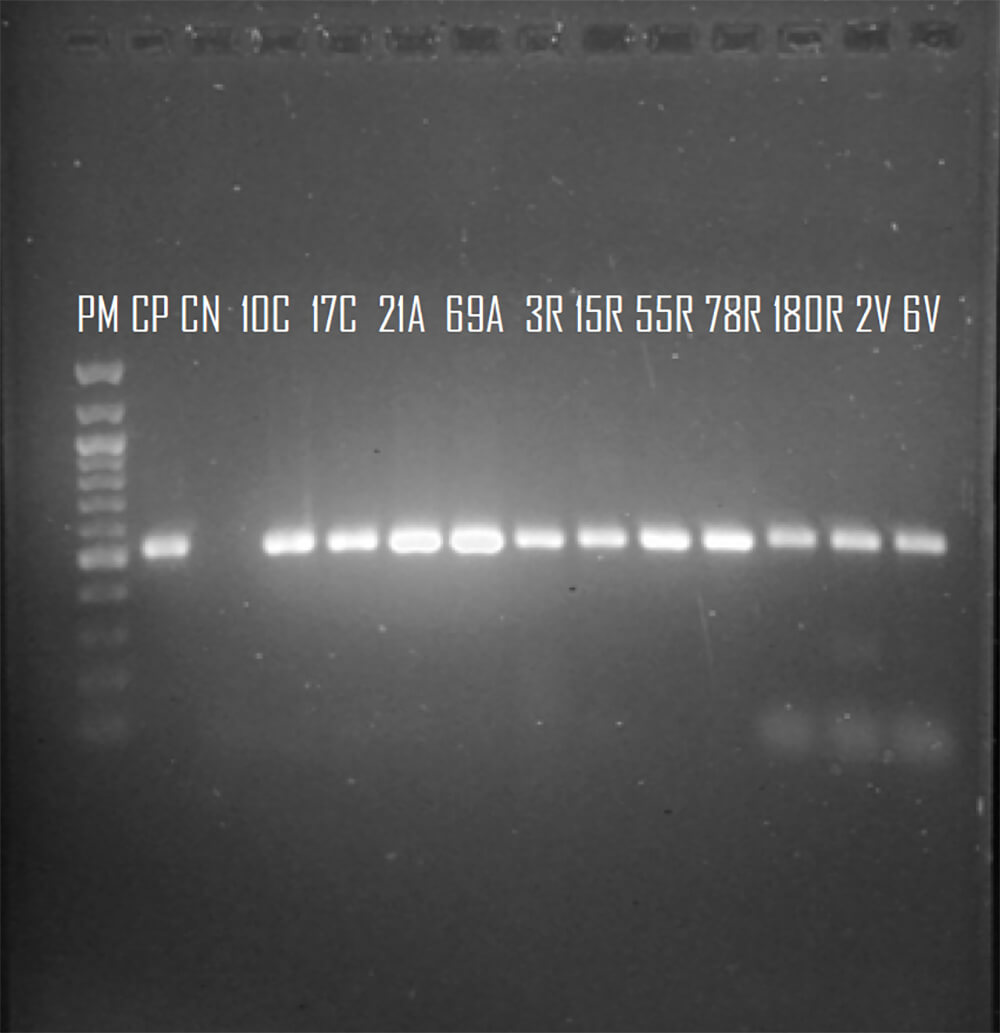 Figura 3. Registro fotográfico de un gel de agarosa al 0,8% donde se observan los amplificados del gen que codifica para OXA 58. Línea 1: 100 pb DNA Ladder (BioLabs), Línea 2 y 3: Control positivo y negativo, Líneas 4-14 aislados clínicos provenientes del Centro Médico de Caracas, Hospital Dr. Domingo Luciani y Hospital Vargas. Fuente: Elaboración propia