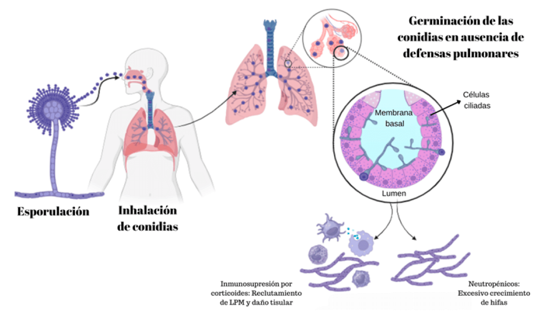 Figura 1. Ciclo evolutivo del género Aspergillus desde su inhalación hasta la interacción con los diferentes tipos de pacientes inmunocomprometidos, bien sea neutropénicos, trasplantados o con inmunosupresores y corticoides. Elaboración propia.