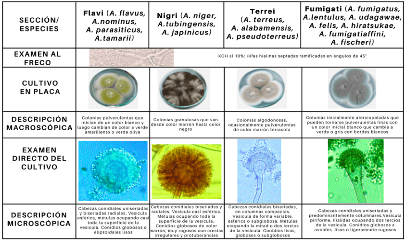 Figura 2. Características microscópicas y macroscópicas de las especies más relevantes de Aspergillus patógenas para el ser humano. Elaboración propia.