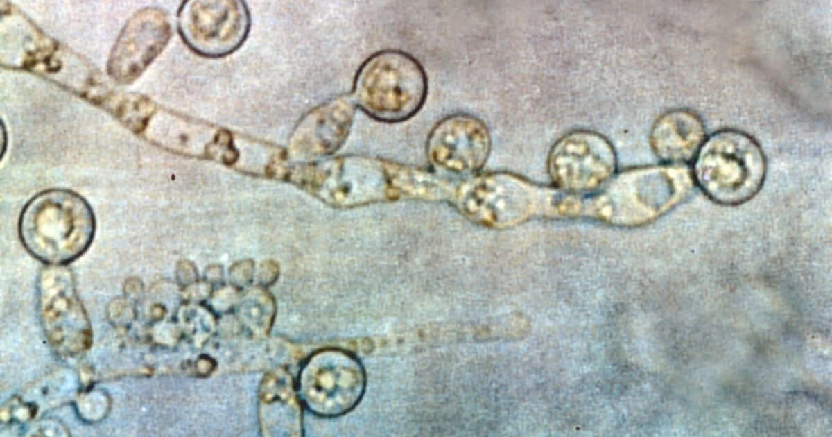 Resazurina como indicador colorimétrico en la susceptibilidad a biopelículas sésiles de Candida spp., aisladas de hemocultivos frente a fluconazol