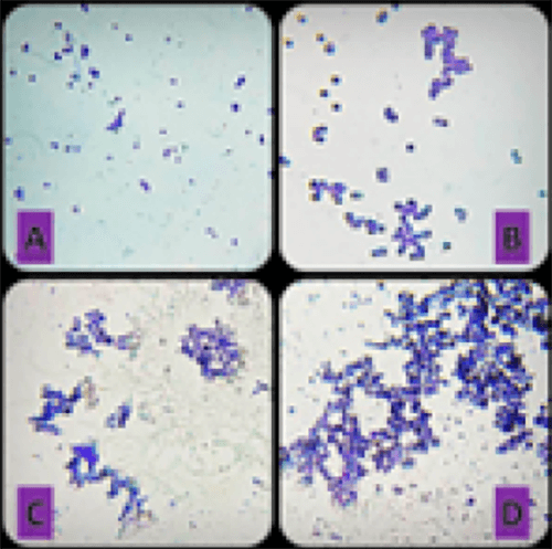 Figura 1. Método en laminillas de vidrio con cristal violeta. A: aislados sin agregación. B: aislado con agregación débil. C: aislado con agregación moderada. D: aislado con agregación fuerte.