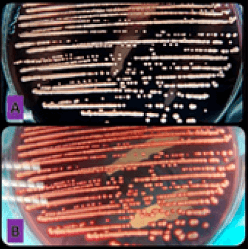 Figura 4. Cambio de color de la pared celular frente al compuesto químico rojo Congo en agar Sabouroud dextrosa, expresando la presencia o no de exopolisacáridos. A: cepa negativa, colonias blancas que no absorbieron ni metabolizaron el rojo Congo. B: cepa positiva, colonia rosado intenso indicando absorción y metabolización del rojo Congo.