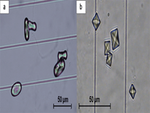 Figura 1. Cristales de oxalato de calcio (400X, microscopia óptica de luz). (a). Típicos Cristales ovalados de whewellita con un núcleo deprimido. (b) Cristales bipiramidales (octaédricos) de weddellita Fuente: Michel Daudon, Vincent Frochot, Dominique Bazin, Paul Jungers. Crystalluria analysis improves signi-ficantly etiologic diagnosis and therapeutic monitoring of nephrolithiasis. Comptes Rendus Chimie. 2016; 19 (11–12): 1514-1526.