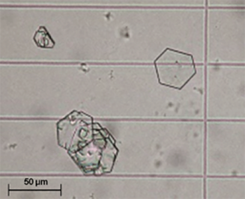 Figura 12. Típico cristal de cistina (400X, microscopia óptica de luz). Fuente: Michel Daudon, Vincent Frochot, Dominique Bazin, Paul Jungers. Crystalluria analysis improves significantly etiologic diagnosis and therapeutic monitoring of nephrolithiasis . Comptes Rendus Chimie. 2016; 19 (11–12): 1514-1526.