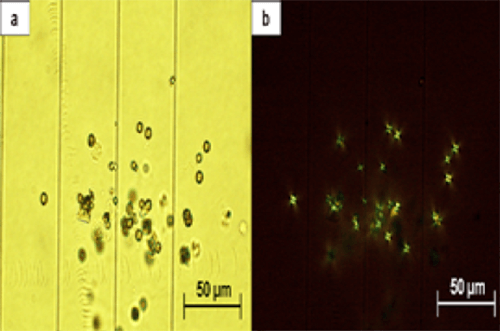 Figura 13. Pequeños cristales esféricos de dihidroxiadenina: (a) microscopía de óptica de luz (400X); (b) microscopía polarizasa (400X). Fuente: Michel Daudon, Vincent Frochot, Dominique Bazin, Paul Jungers. Crystalluria analysis improves significantly etiologic diagnosis and therapeutic monitoring of nephrolithiasis. Comptes Rendus Chimie. 2016; 19 (11–12): 1514-1526.