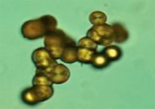 Figura. 14 Cristales de xantina (400X, microscopia óptica de luz). Fuente: Mundt, Lillian; Shanahan, Kristy. Graff. Análisis de orina y de los líquidos corporales. México: Panamericana; 2011.