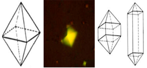 Figura 24. Cristales de Oxalato de Calcio dihidratado. (A) Figura de la bipiramide tetragonal (hábitat octaedrico) del Oxalato cálcico dihidratado. (B) Ejemplo de Oxalato cálcico dihidratado octaedrico gigante (200X, microscopia polarizada). (C) Figuras de la bipiramide tetragonal con crecimiento prismático moderado y muy acusado de la base de unión interpiramidal adquiriendo el tipo dodecaedrico. Constituye un signo inequívoco de patología que se asocia a una hipercalciuria severa (>10 mmol/24h) con o sin litiasis. (D) Ejemplos de Oxalato cálcico dihidratado dodecaedrico. Fuente: Dalet, Fernando. El sedimento urinario: ¿qué hay de nuevo en algo tan viejo?. Act Fund Puigvert 1999;18(3):135-48