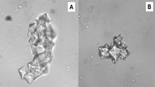 Figura 30. (A) Agregado de cristales de Oxalato cálcico dihidratado (200X, microscopia contraste de fase). (B) Agregado de maclas de cristales de Oxalato cálcico dihidratado (200X, microscopia constraste de fase). Constituye el máximo riesgo litogeno. Fuente: Dalet, Fernando. El sedimento urinario: ¿qué hay de nuevo en algo tan viejo?. Act Fund Puigvert 1999;18(3):135-48
